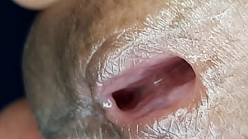 Uretra do penis em close up
